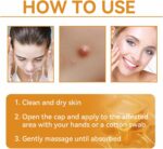 Ximonth Bee Venom Wart Cream Bee Venom Repair Cream