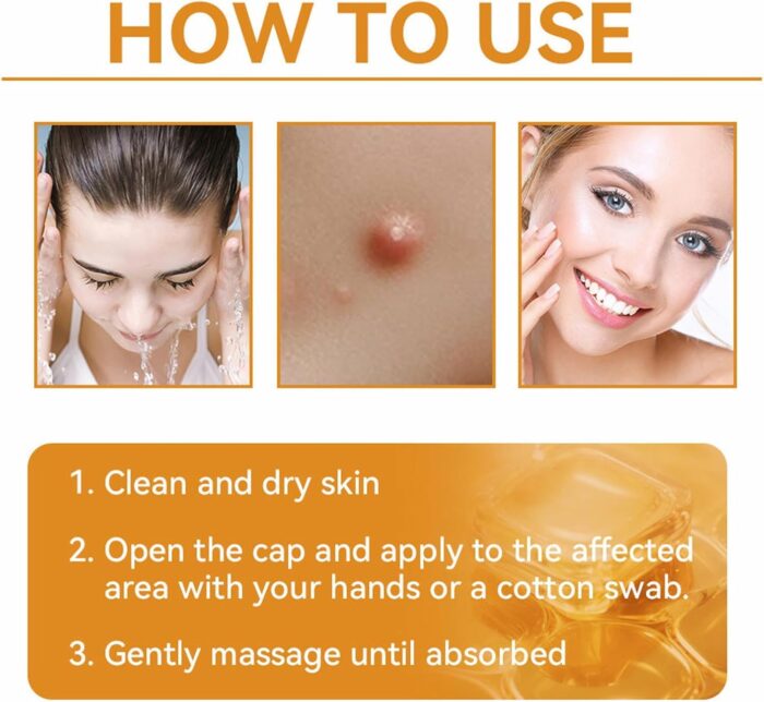 Ximonth Bee Venom Wart Cream Bee Venom Repair Cream