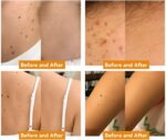 Ximonth Bee Venom Wart Cream Bee Venom Repair Cream