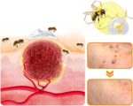 Ximonth Bee Venom Wart Cream Bee Venom Repair Cream