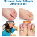 Ximonth Foot Spray with Tea Tree Oil Tea Tree Oil Feet Spray 2PCS
